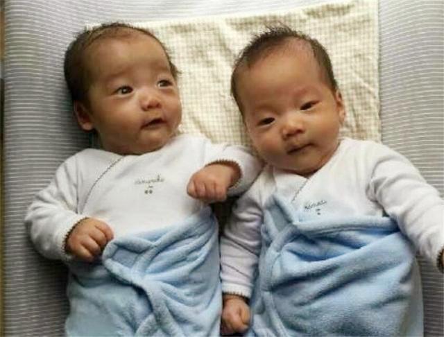 分裂|女子生下双胞胎,却被查出不是同一个父亲,亲子鉴定师:概率极低