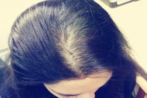 “孕丑”也会挑人！怀孕后颜值下降的孕妈，是有共同点的