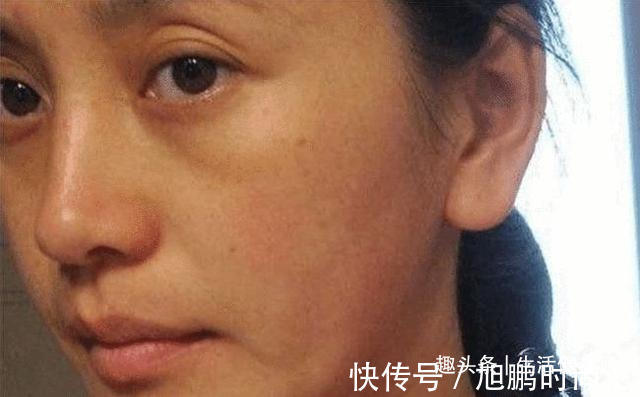 维生素e 50岁以上的老阿姨，想要告别黄脸婆，4个护肤妙招，方便又实用！