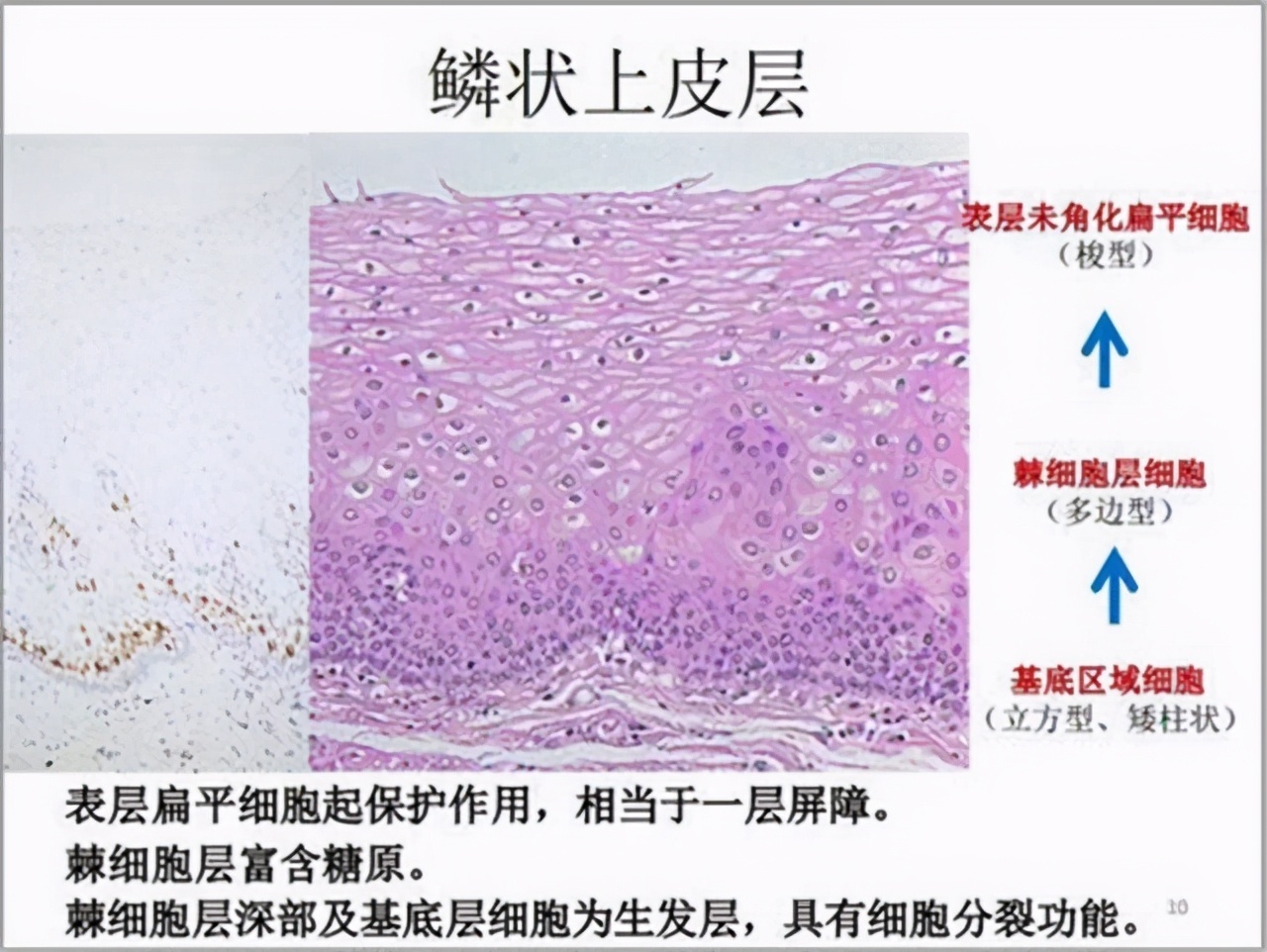 慢性咽喉炎|慢性咽炎就诊，却查出了食管癌，二者该如何分辨医生告诉你