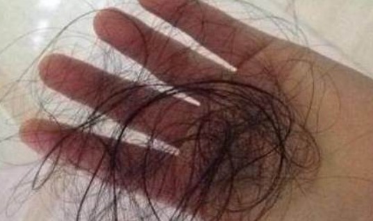 病理性脱发|洗头时大把掉头发,用不起眼的厨房便宜食材洗头,头发黑亮又浓密