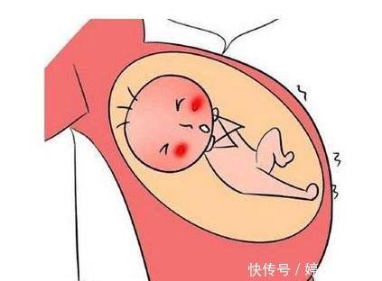 如何判断自己是否怀孕?别不信,很多人不知道