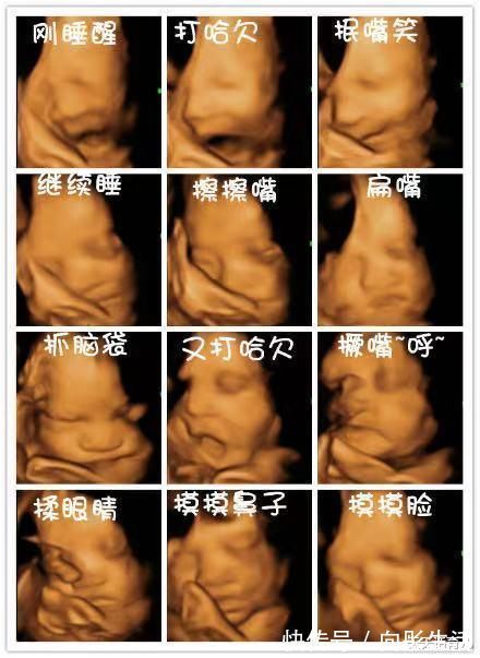 四维|为何有的医院做四维彩超不让家属陪?3大原因,孕妇有权知道