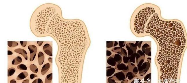 站桩|一个不花钱的养生妙方!每天5分钟,身体收获8大益处!防病又强身