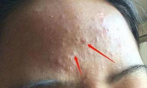 女人|子宫好的女人,脸上没有4种变化,若都没有,子宫很不错