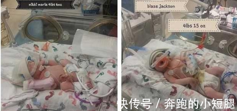 女子|腹痛难忍以为是结石,竟连续生下三胞胎,医生:怀孕34周都不知道