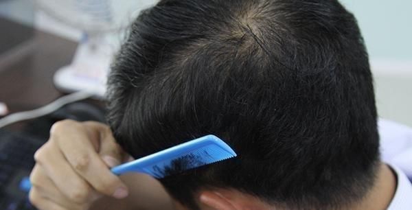 做俯卧撑|46岁男子，每天做50个俯卧撑，3个月后得到了什么你也可以试试