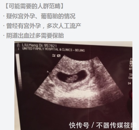 盆底肌|新妈必读!孕期务必小心的五大注意事项!不看当心“害娃又害己”