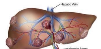 肝脏|肝脏不好的人，身体或有这6个表现，不妨自测一下