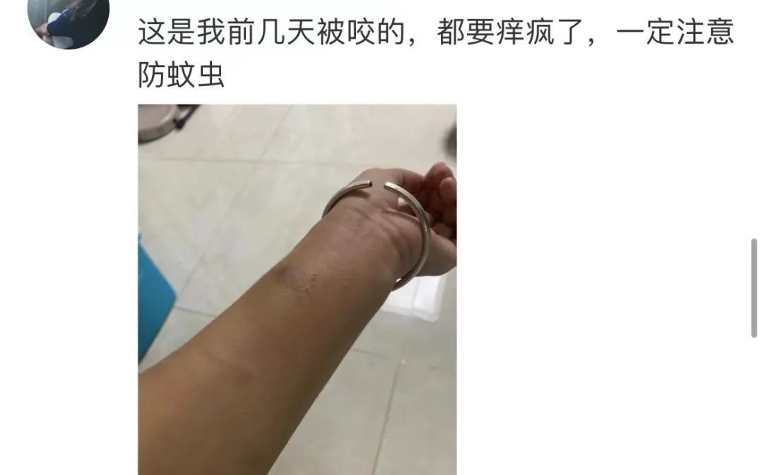 医生|被蚊子咬了一口,孕妈紧急剖宫产保命!1岁宝宝也中招!医生紧急提醒……