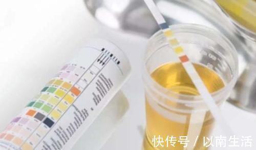 肾脏健康|男性早起“第一次解手”时有3种表现，恭喜，肾还不错