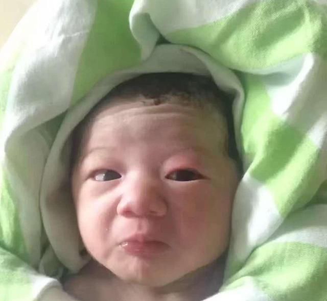 女孩脸上有这5种“美人线”，小时候再丑也不怕，女大定会十八变