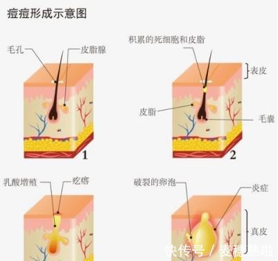 油皮 还在羡慕别人皮肤好护肤品可千万不要跟风,先看这一点!