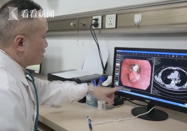 肺部|男子啃鸭脖骨头卡进肺部，20年后才被取出？！