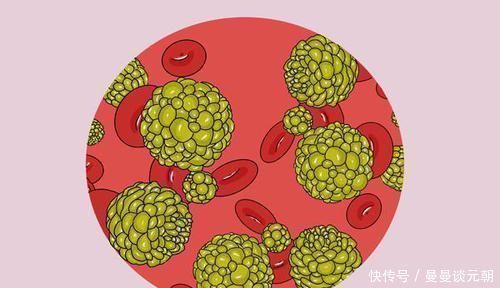 非小细胞癌|得了肺癌，究竟还能活多久熬过五年生存期，是不是就安全了