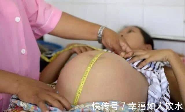 腹带|同是孕妇有人不长妊娠纹?有四个特征的孕妈不会被妊娠纹困扰