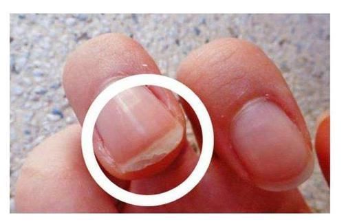 手指|手上出现这9个表现，可能是体内疾病发出的求救信号，别不当回事！