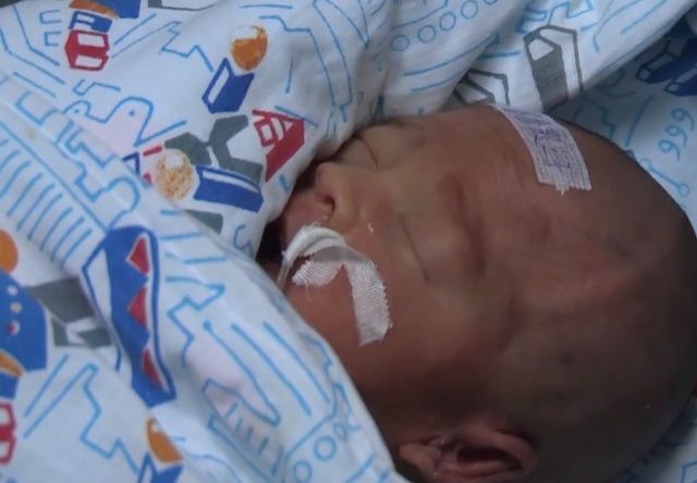 儿科|儿媳怀孕8个月早产,生下孩子窒息进ICU要花1万,家里人都犹豫了