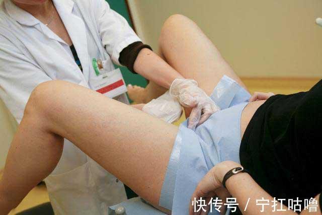 凝胶|618囤的痔疮膏,这才一个多月痔疮就快好了?一线专家的治疗手段果真特殊!