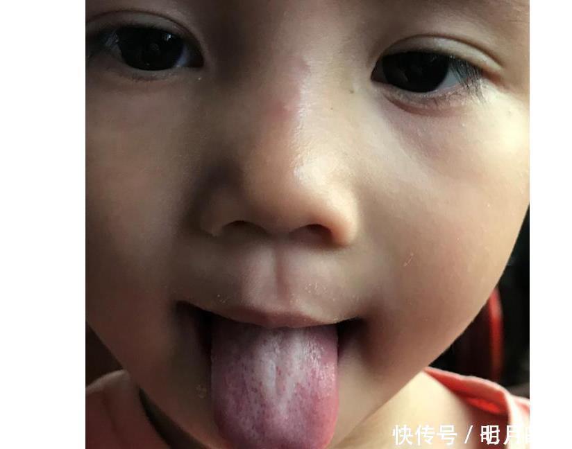 脾胃|4岁女童积食1年没长个,不爱零食,却贪食这物,埋下毒素