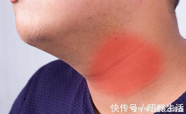 忌口|查出甲状腺结节,就不能吃海带了?专家:真正该忌口的是2种食物