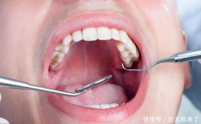 蛀牙真是被“蛀虫”咬的吗?3D动画演示全程,看着都感觉疼!