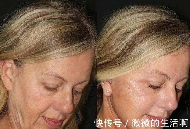 医美 别拿宝贵的脸去“试错”,医美项目得这么选(医生经验总结)!