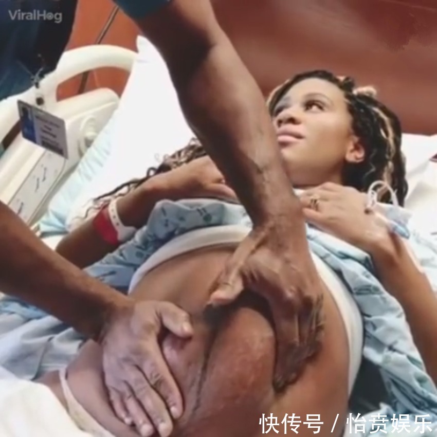 枕前位|医生徒手帮孕妈转胎位，当妈真的不容易，网友这肚皮都薄成纸了