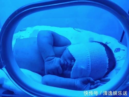 新生儿黄疸|宝宝出生后没黄疸,八成是孕妈在孕期做了3件事,对大人孩子都好