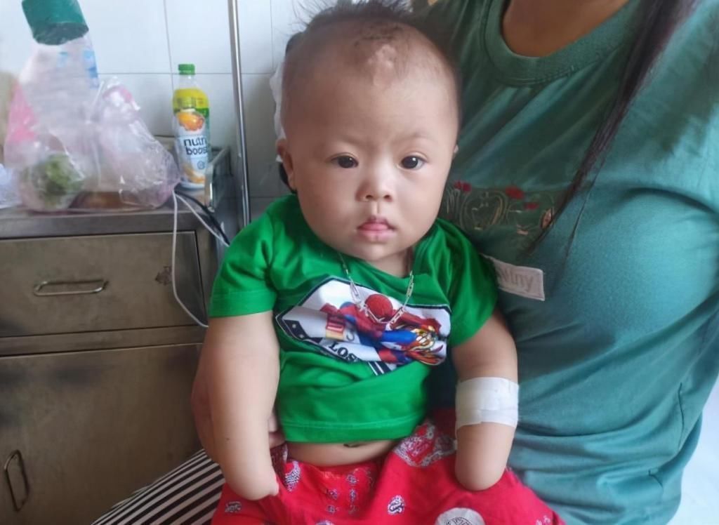 产检|孕妈十次产检,医生每次都说胎儿正常,娃出生后妈妈差点哭瞎双眼