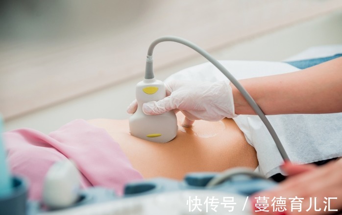 检查|NT检查,不可错过的第一次排畸检查