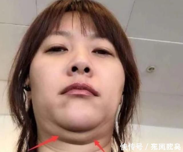 低头玩手机|女生脸部“尺寸”越来越大多半有这3习惯,难怪你是大脸盘子