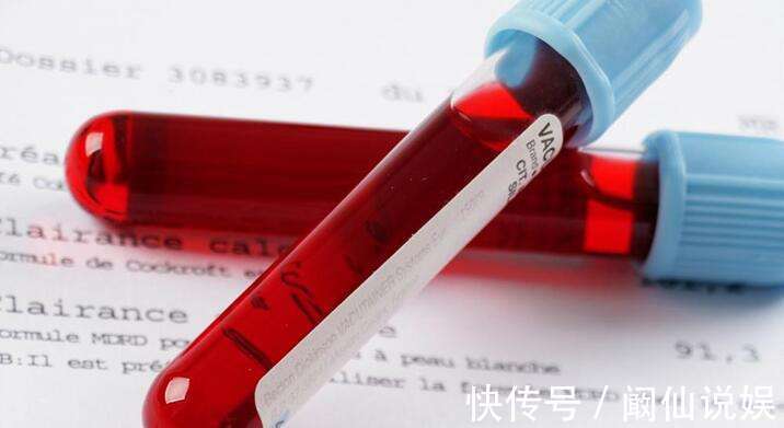 甘油三酯|高血脂的“祸根”，与盐无关，世卫组织提醒“1酸”少往嘴里送