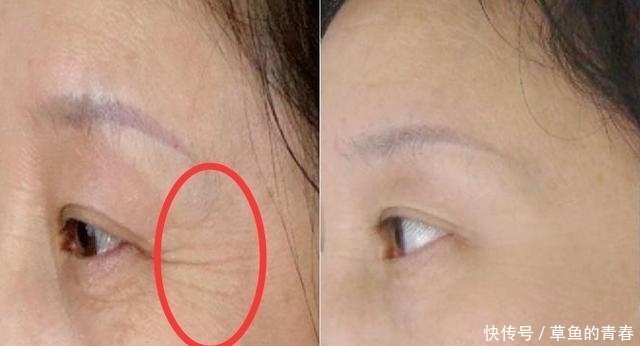 皱纹爬上脸部很显老?每晚睡前常抹皱纹克星,皮肤紧致皱纹减淡