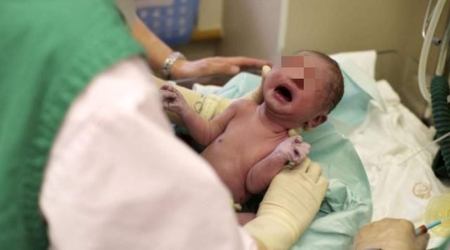 准妈妈|顺产虽然比剖腹产恢复快,但是剖腹产有三个好处,顺产比不了