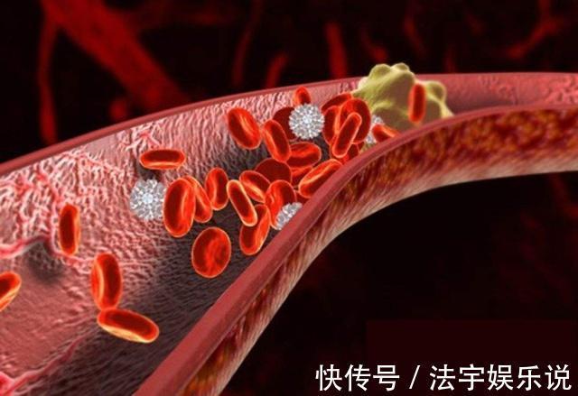 血管|血管好不好，伸出手一看就知道，没有4个表现，恭喜你血管很好！