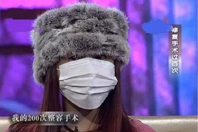 整容 她16岁开始整容,花400多万做过200多次手术,如今成了这样