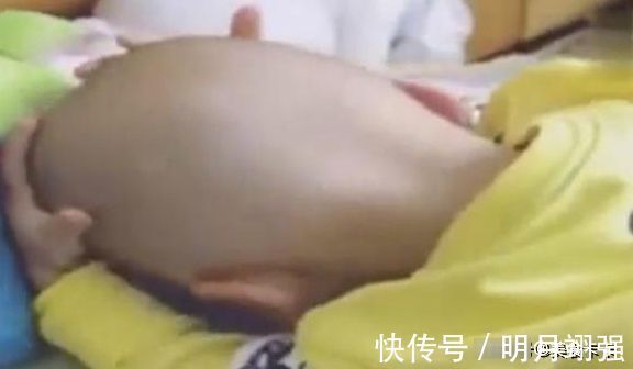 午睡|2岁宝宝午睡,一觉醒来发现头发没了,随后宝宝的反应,萌萌哒!