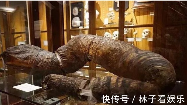 游客|他三年没上大便活活憋死,巨型大肠被放博物馆展览,吸引百万游客