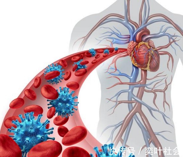 胆固醇|血管''堵''的人，少碰2黄，多做4事，坚持1月，胜吃溶栓药