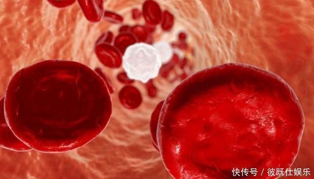 脂质|血脂的“帮凶”找到了,主任医生每天补一物,坚持半月,血管净