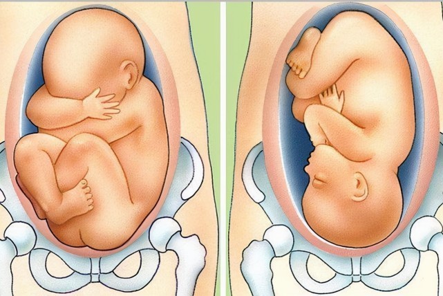 入盆|胎儿入盆为什么头部向下,胎儿头部不会充血吗?