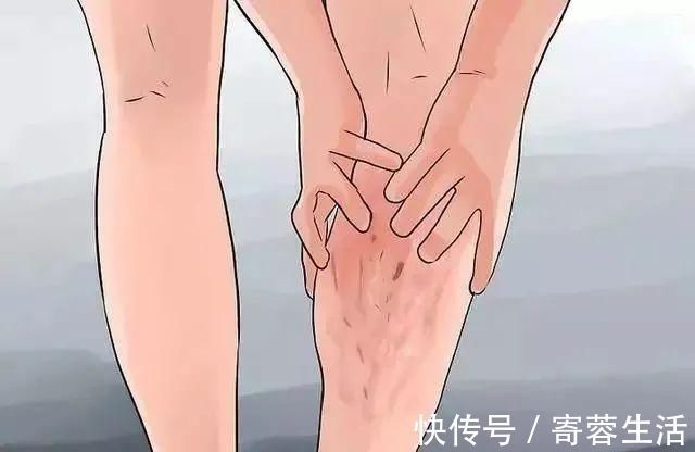 血液粘稠度|血液粘稠的人,身体会有5种表现,若没有,说明血管还算通畅