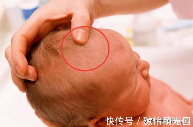 前囟门|宝宝囟门是健康“灯塔”,若出现几种信号,可能健康亮了“红灯”