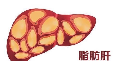 治疗|医生不隐瞒:肝癌发展期需经历4个阶段,把握时机,有利控制病情