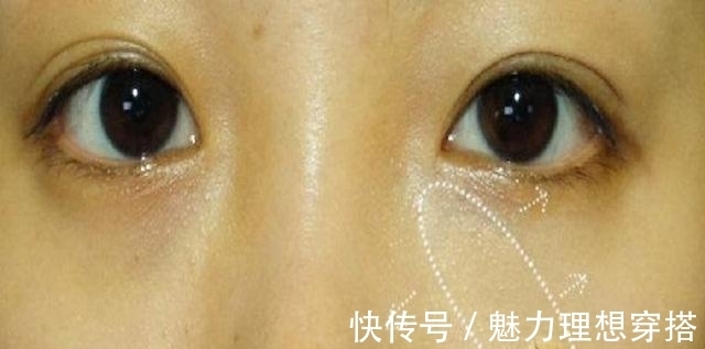 脸部|女性脸部有4个“症状”别马虎，可能得了妇科病，要足够重视