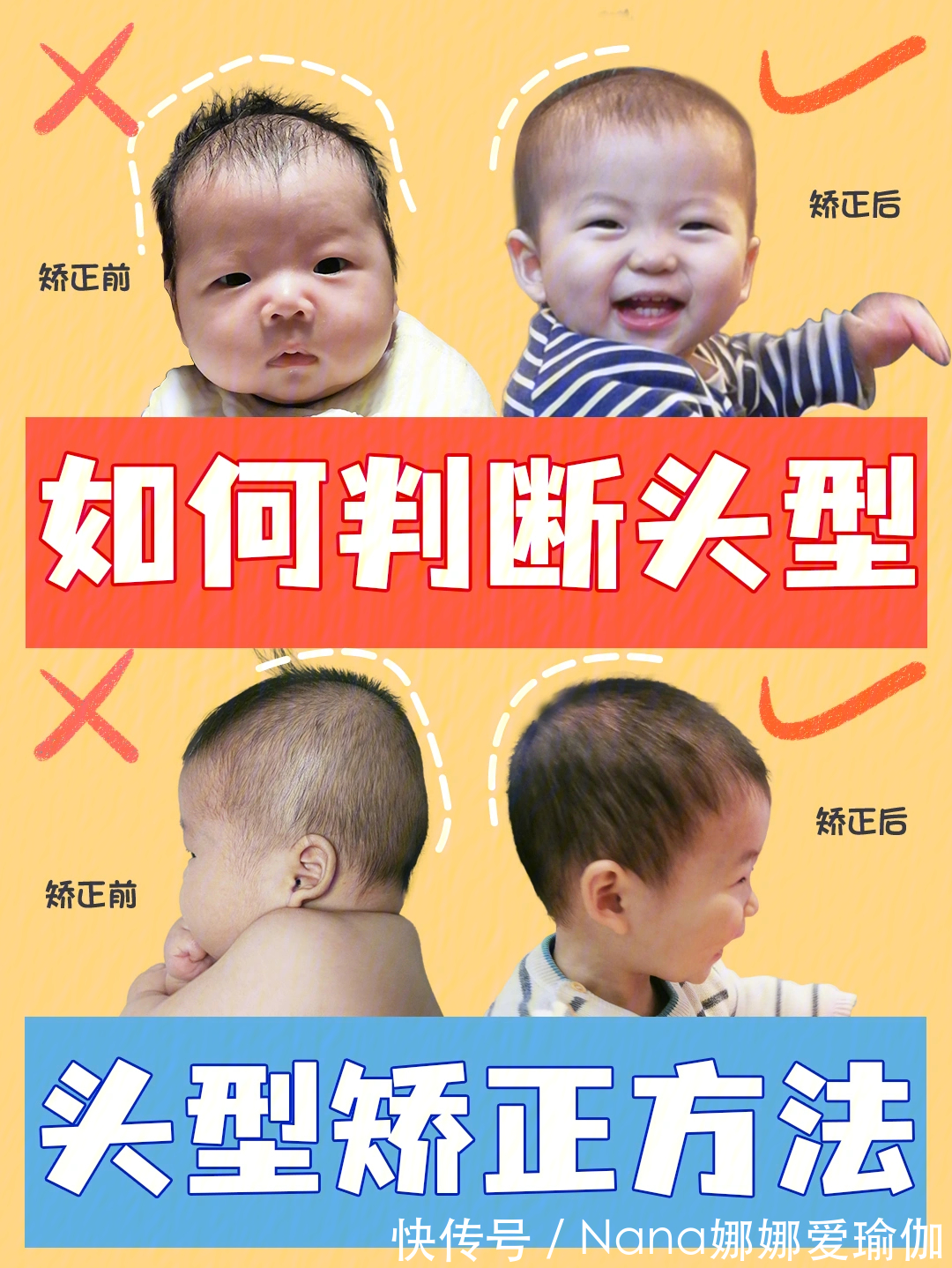 睡姿|宝宝睡圆头矫正头型,保姆级教程来了!