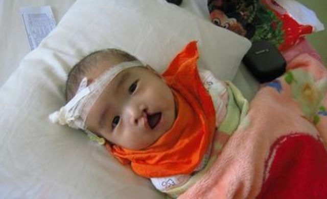 妈妈|怀孕6个月查出兔唇,全家人伤心不已,医生诊断:宝爸要背锅了