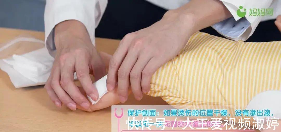 逆天改命|张杰被3cm鱼刺卡喉,他做了一件最正确的事,值得妈妈们学习!