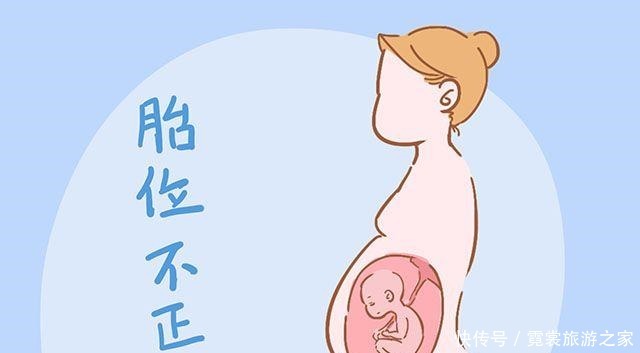 顺产固然好，但遇见这几种情况时只能剖腹产，别傻乎乎不知道